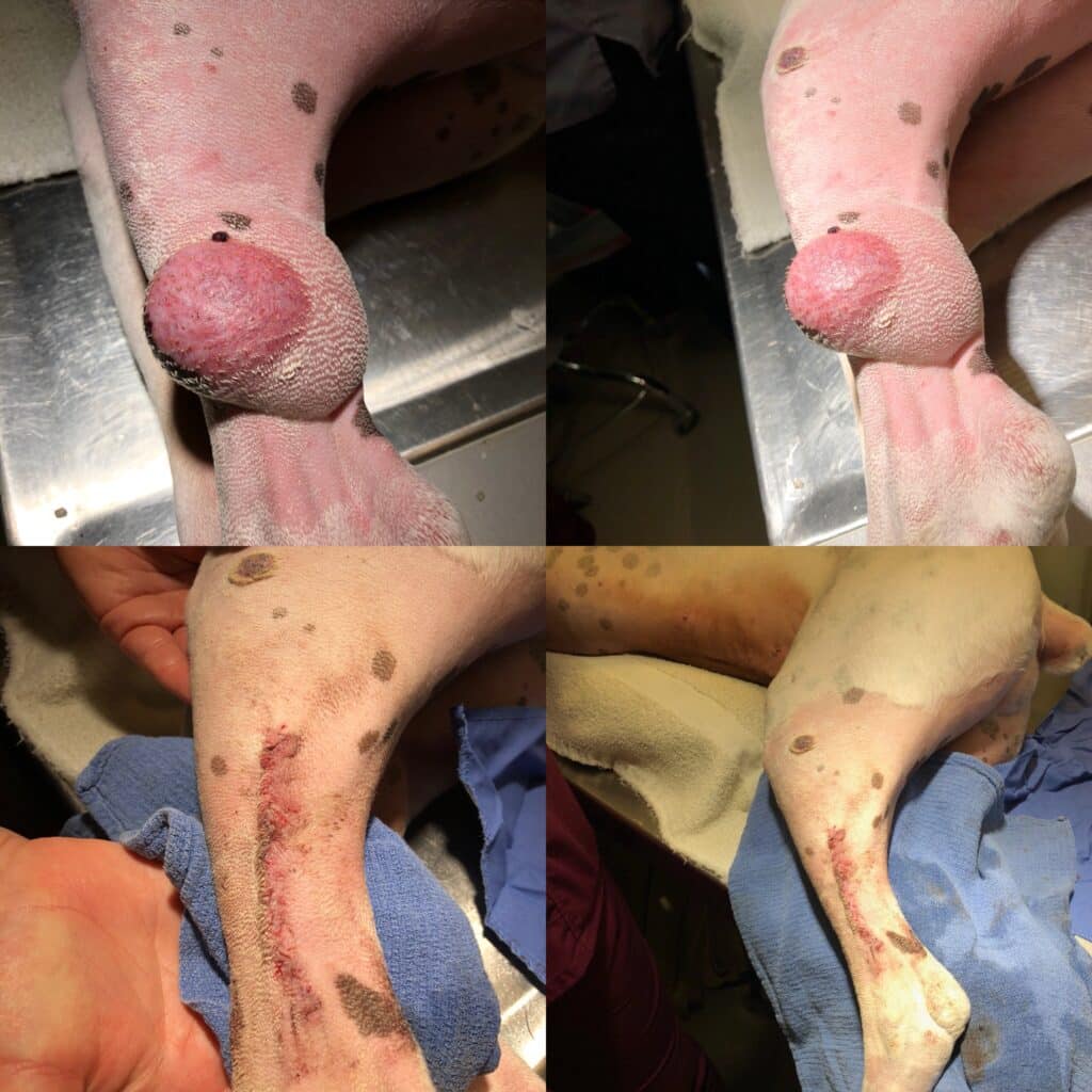 Dr. Kelly's Surgical Unit, cyst removal on leg, before and after pictures